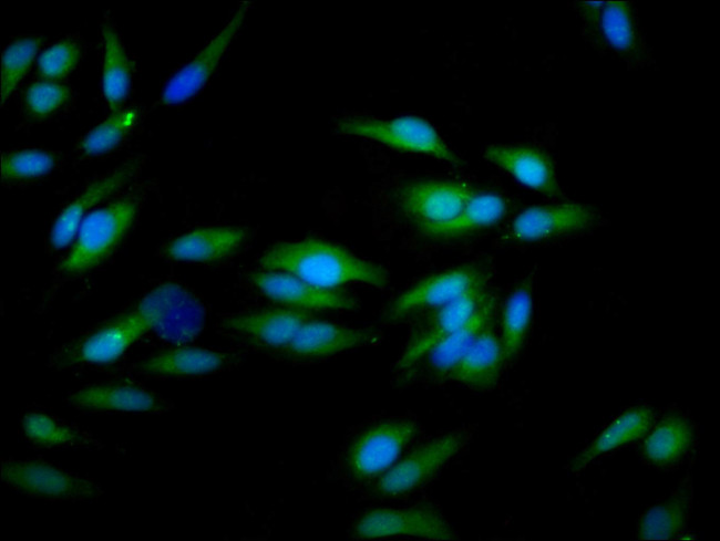 CD51 Antibody in Immunocytochemistry (ICC/IF)