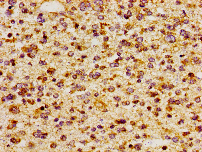 CD51 Antibody in Immunohistochemistry (Paraffin) (IHC (P))