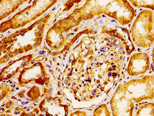 CD51 Antibody in Immunohistochemistry (Paraffin) (IHC (P))