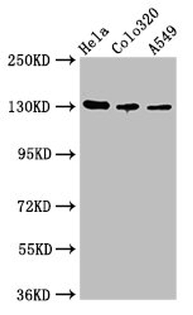 CD51 Antibody in Western Blot (WB)