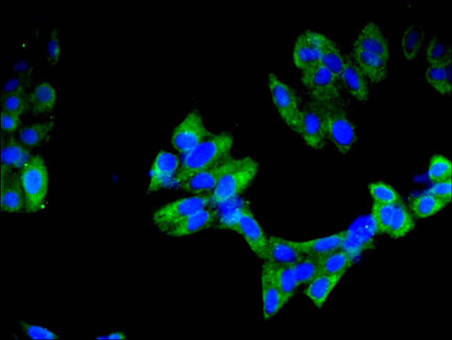 IMPDH2 Antibody in Immunocytochemistry (ICC/IF)