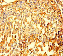 IMPDH2 Antibody in Immunohistochemistry (Paraffin) (IHC (P))