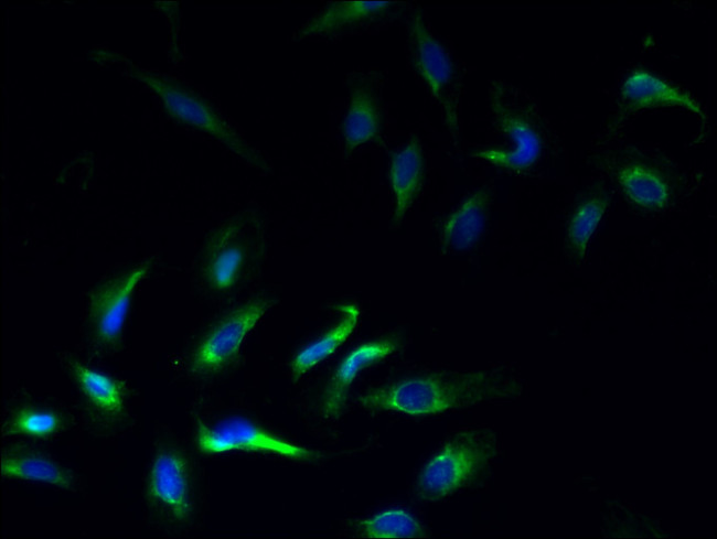 Kir1.1 (KCNJ1) Antibody in Immunocytochemistry (ICC/IF)