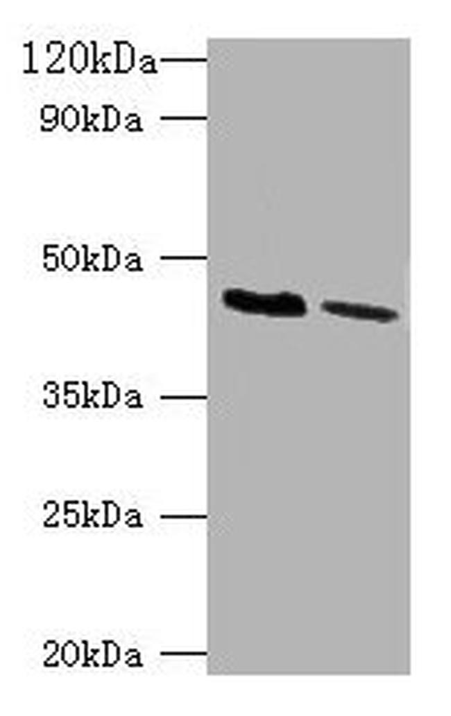 Kir1.1 (KCNJ1) Antibody in Western Blot (WB)