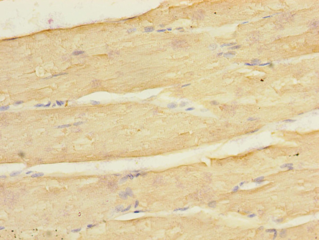 Kir2.3 (KCNJ4) Antibody in Immunohistochemistry (Paraffin) (IHC (P))