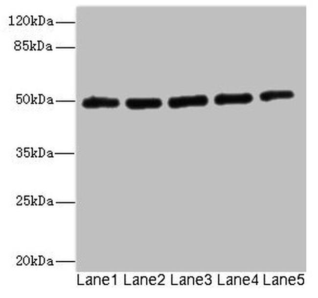 Kir2.3 (KCNJ4) Antibody in Western Blot (WB)