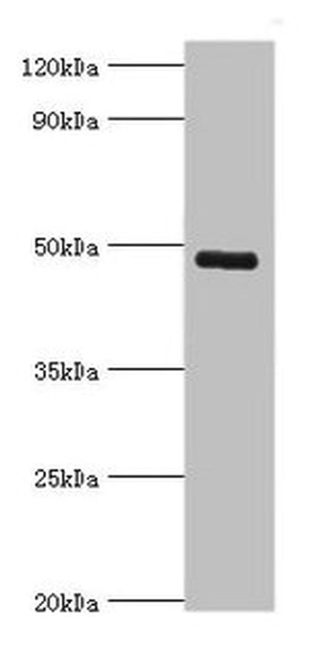 KCNN4 Antibody in Western Blot (WB)