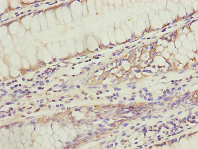 KIAA0391 Antibody in Immunohistochemistry (Paraffin) (IHC (P))