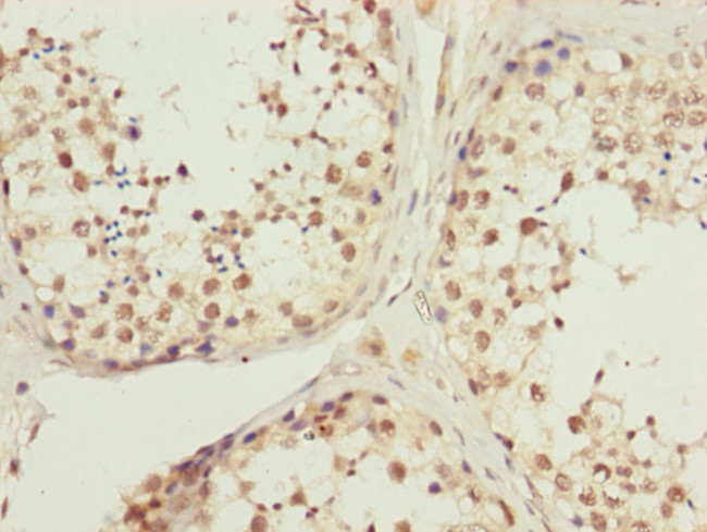 KIAA0391 Antibody in Immunohistochemistry (Paraffin) (IHC (P))