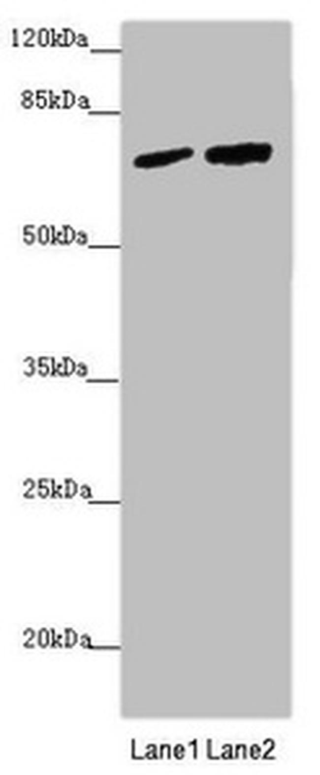 KIAA0391 Antibody in Western Blot (WB)