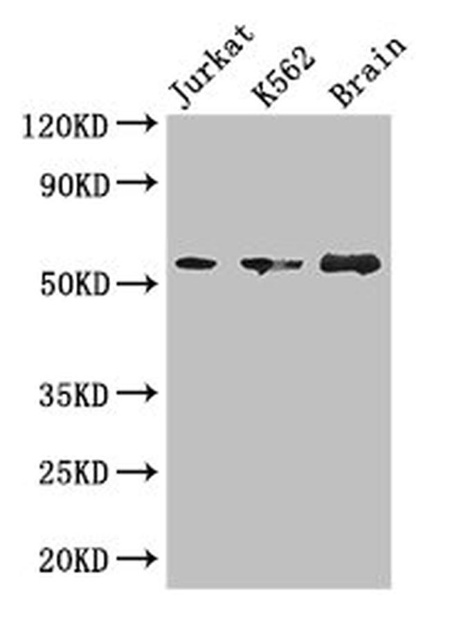 KIAA0513 Antibody in Western Blot (WB)