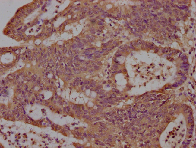 LCHN Antibody in Immunohistochemistry (Paraffin) (IHC (P))