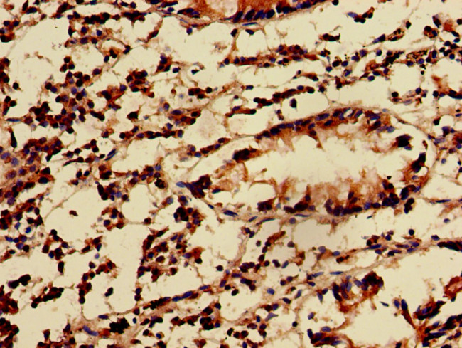 KIDINS220 Antibody in Immunohistochemistry (Paraffin) (IHC (P))