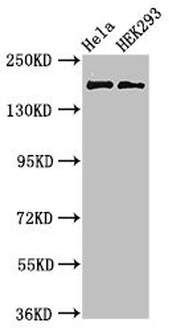KIDINS220 Antibody in Western Blot (WB)