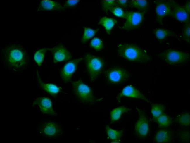 KIF3C Antibody in Immunocytochemistry (ICC/IF)