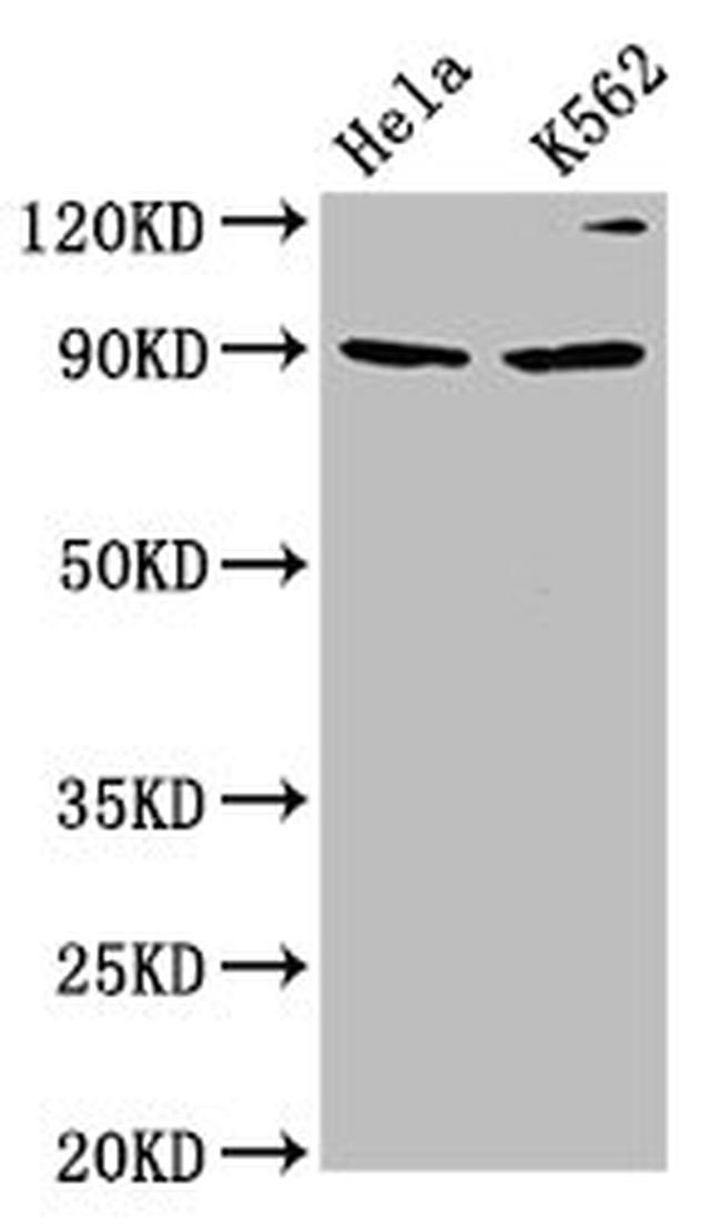 KIF3C Antibody in Western Blot (WB)