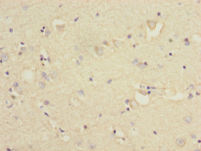 KLC1 Antibody in Immunohistochemistry (Paraffin) (IHC (P))