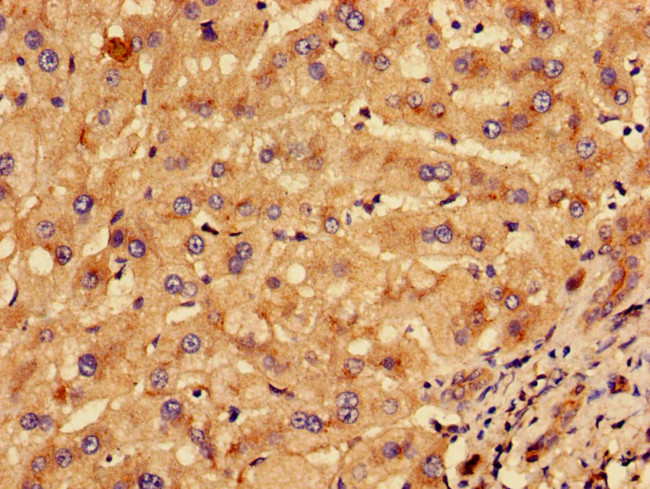 KLHL2 Antibody in Immunohistochemistry (Paraffin) (IHC (P))