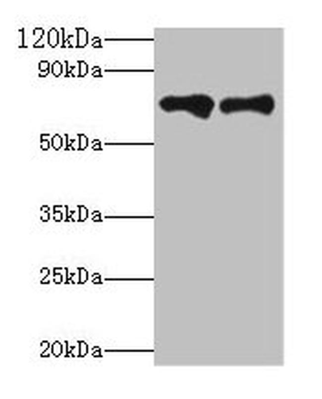 Plasma Kallikrein Antibody in Western Blot (WB)