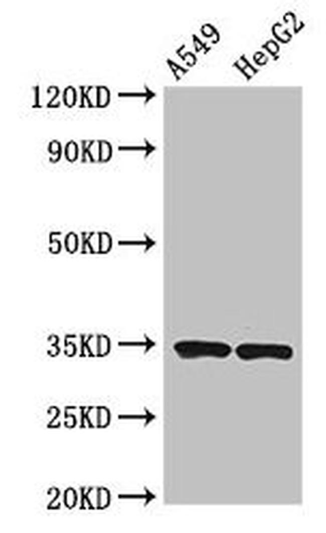 NKG2D Antibody in Western Blot (WB)