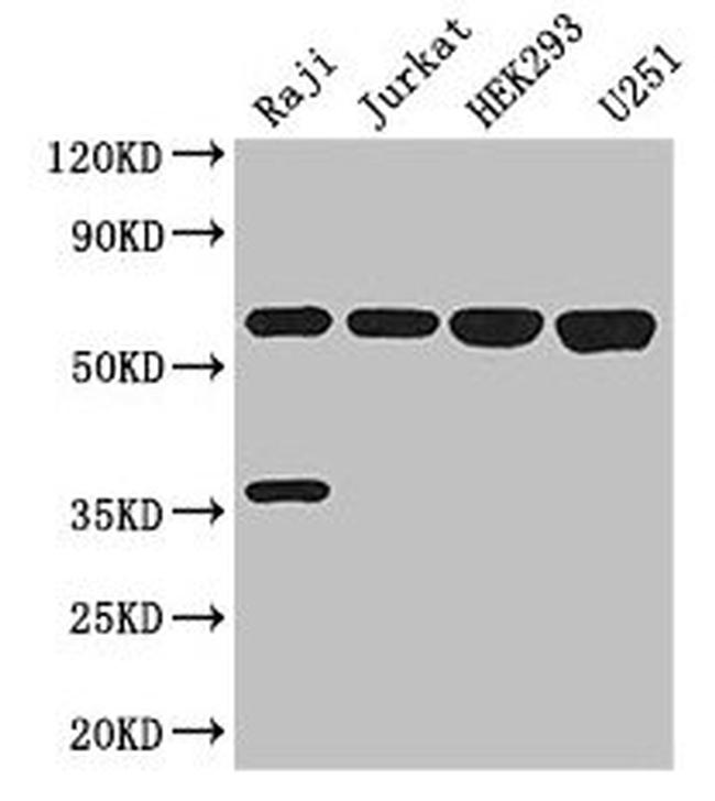 KPNA2 Antibody in Western Blot (WB)