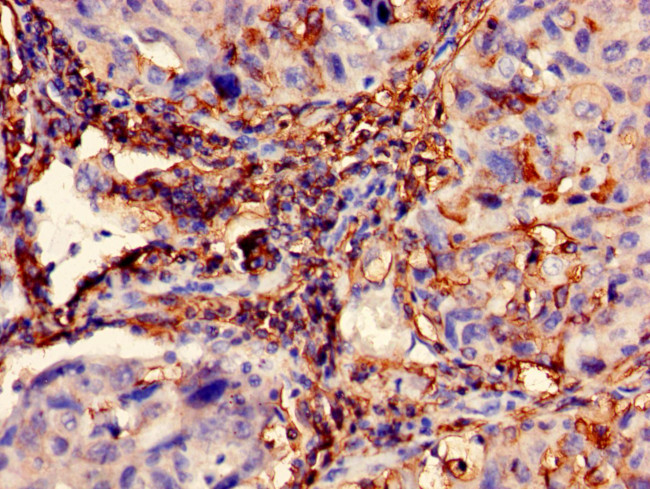 Cytokeratin 10 Antibody in Immunohistochemistry (Paraffin) (IHC (P))