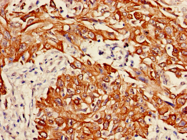 Cytokeratin 6A Antibody in Immunohistochemistry (Paraffin) (IHC (P))