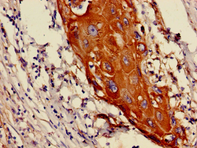 Cytokeratin 6A Antibody in Immunohistochemistry (Paraffin) (IHC (P))