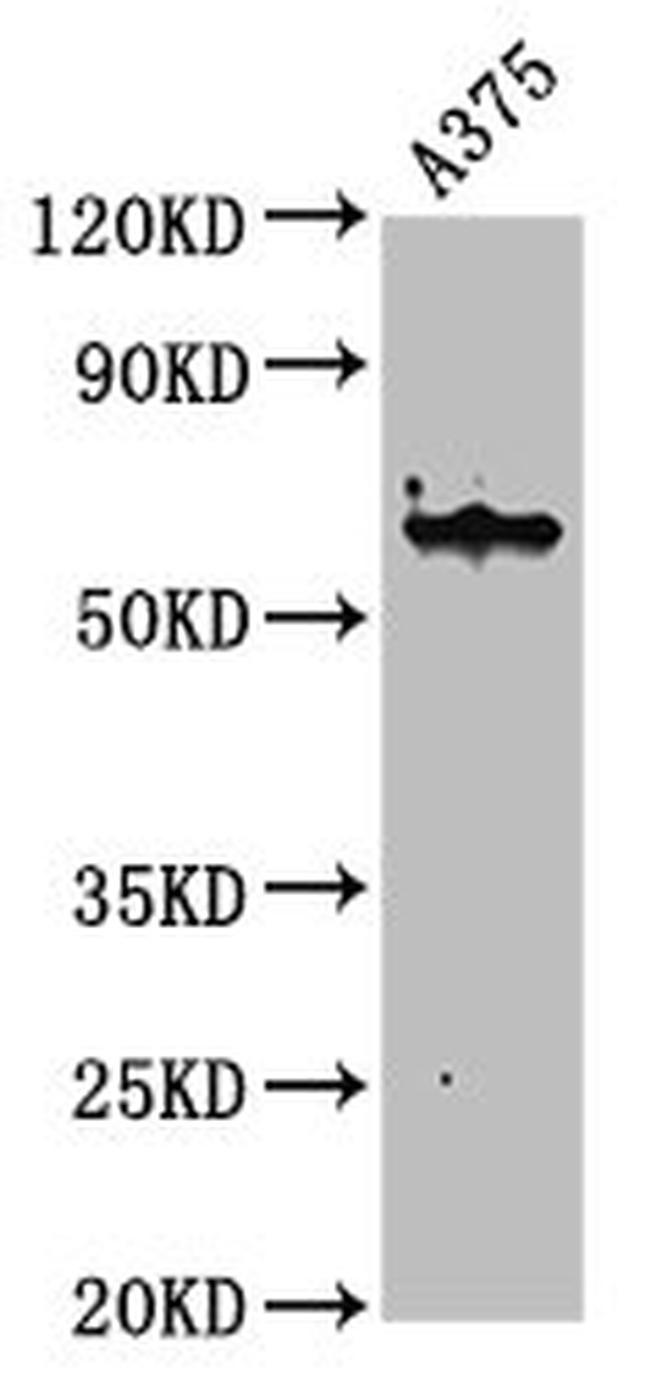 Cytokeratin 6A Antibody in Western Blot (WB)