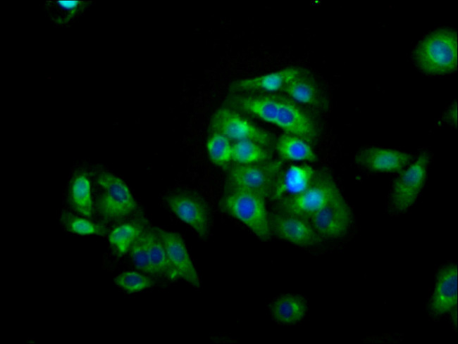 CD223 Antibody in Immunocytochemistry (ICC/IF)