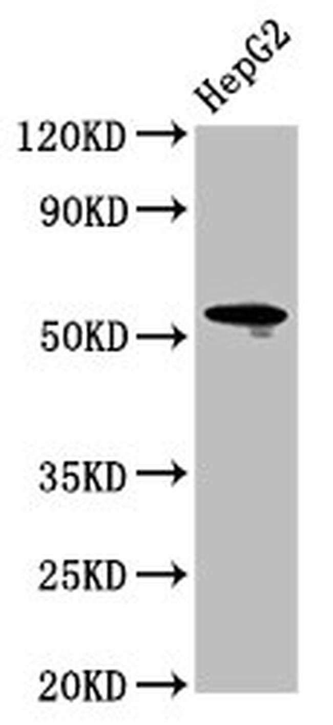 CD223 Antibody in Western Blot (WB)