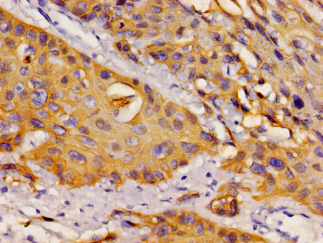 DYNLL1 Antibody in Immunohistochemistry (Paraffin) (IHC (P))