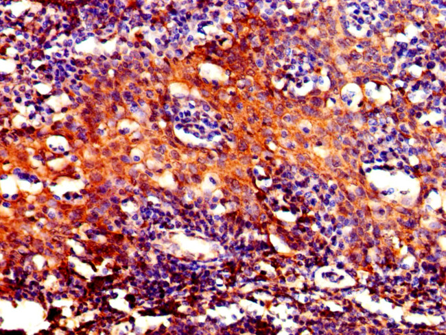 DYNLL1 Antibody in Immunohistochemistry (Paraffin) (IHC (P))