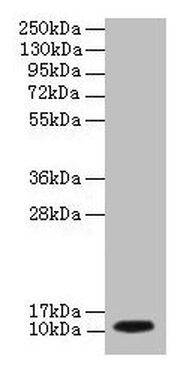 DYNLL1 Antibody in Western Blot (WB)