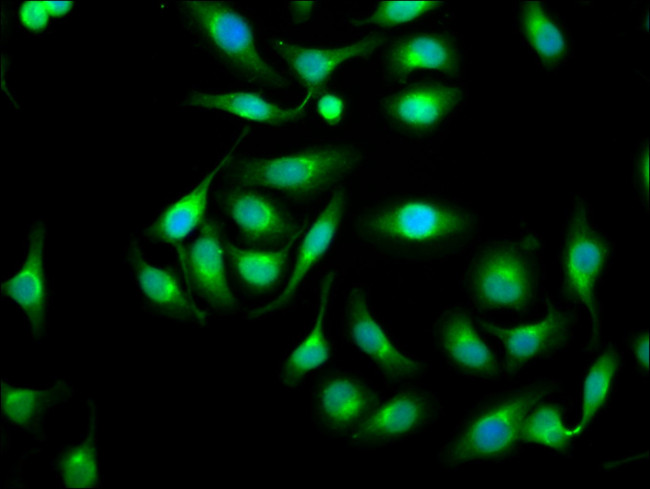 Galectin 1 Antibody in Immunocytochemistry (ICC/IF)