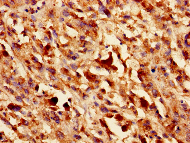 Galectin 1 Antibody in Immunohistochemistry (Paraffin) (IHC (P))