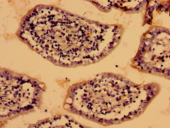 LIAS Antibody in Immunohistochemistry (Paraffin) (IHC (P))