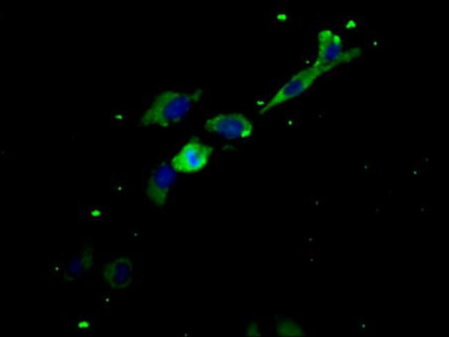 LIFR Antibody in Immunocytochemistry (ICC/IF)