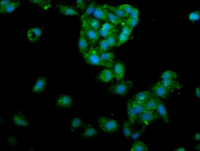 LIPA Antibody in Immunocytochemistry (ICC/IF)