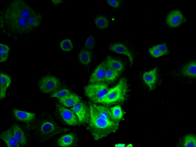 LMF2 Antibody in Immunocytochemistry (ICC/IF)