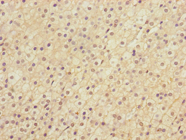 LRP4 Antibody in Immunohistochemistry (Paraffin) (IHC (P))