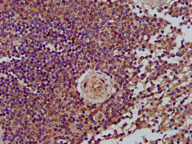 LRP130 Antibody in Immunohistochemistry (Paraffin) (IHC (P))