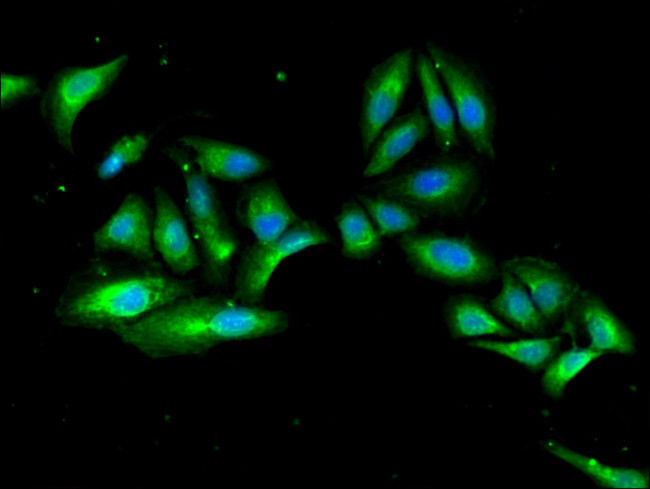 EMP Antibody in Immunocytochemistry (ICC/IF)