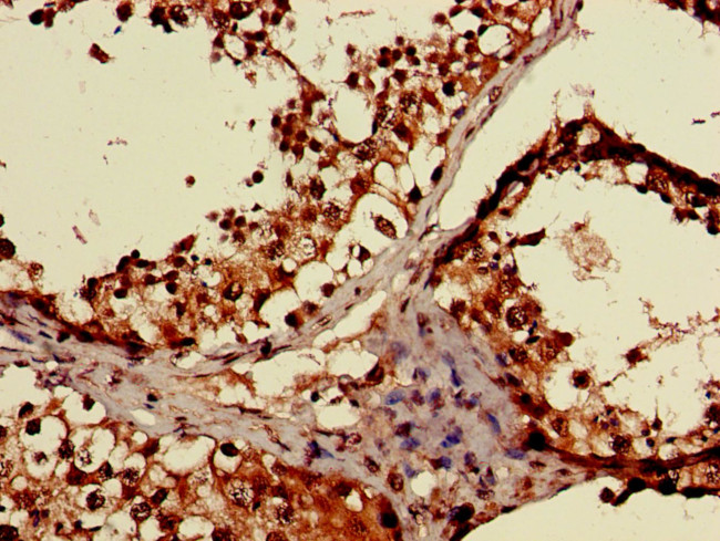 EMP Antibody in Immunohistochemistry (Paraffin) (IHC (P))