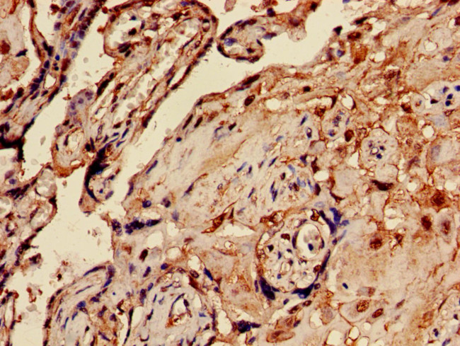 MAGEA10 Antibody in Immunohistochemistry (Paraffin) (IHC (P))