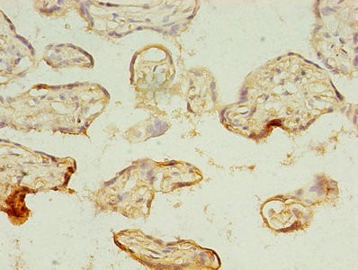 MAGEA10 Antibody in Immunohistochemistry (Paraffin) (IHC (P))