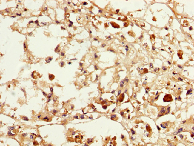 MAGEA3 Antibody in Immunohistochemistry (Paraffin) (IHC (P))