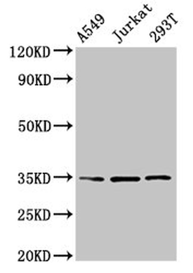 MAGEA3 Antibody in Western Blot (WB)