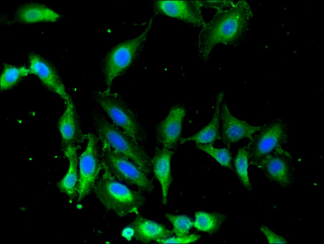 p38 MAPK gamma Antibody in Immunocytochemistry (ICC/IF)