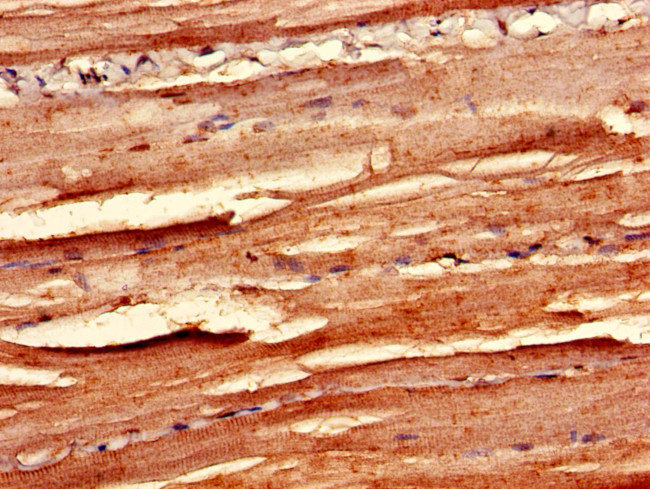 p38 MAPK gamma Antibody in Immunohistochemistry (Paraffin) (IHC (P))